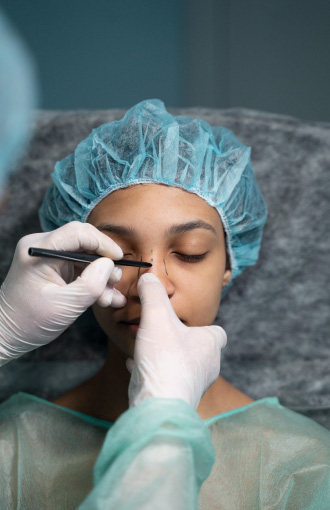 Cirugía de la Nariz 12 rinoplastia dr. Juan Carlos Corena