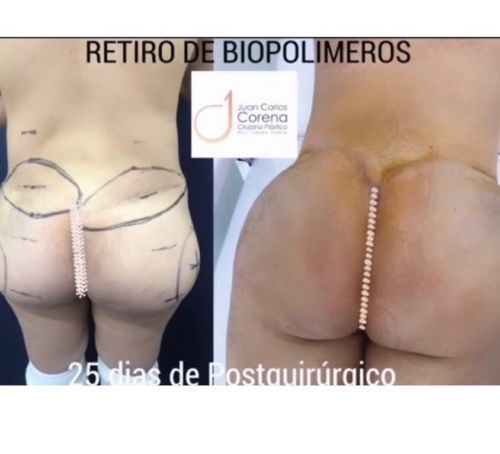 biopol web